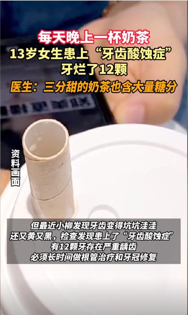 杭州13岁女生每天一杯奶茶牙被腐蚀：患有严重龋齿